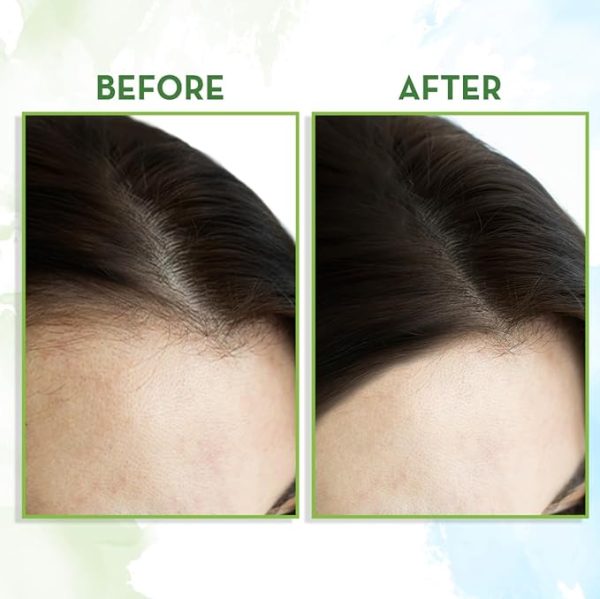 Mamaearth Rosemary Hair Growth Oil 7